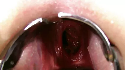 التدلي الروسي
